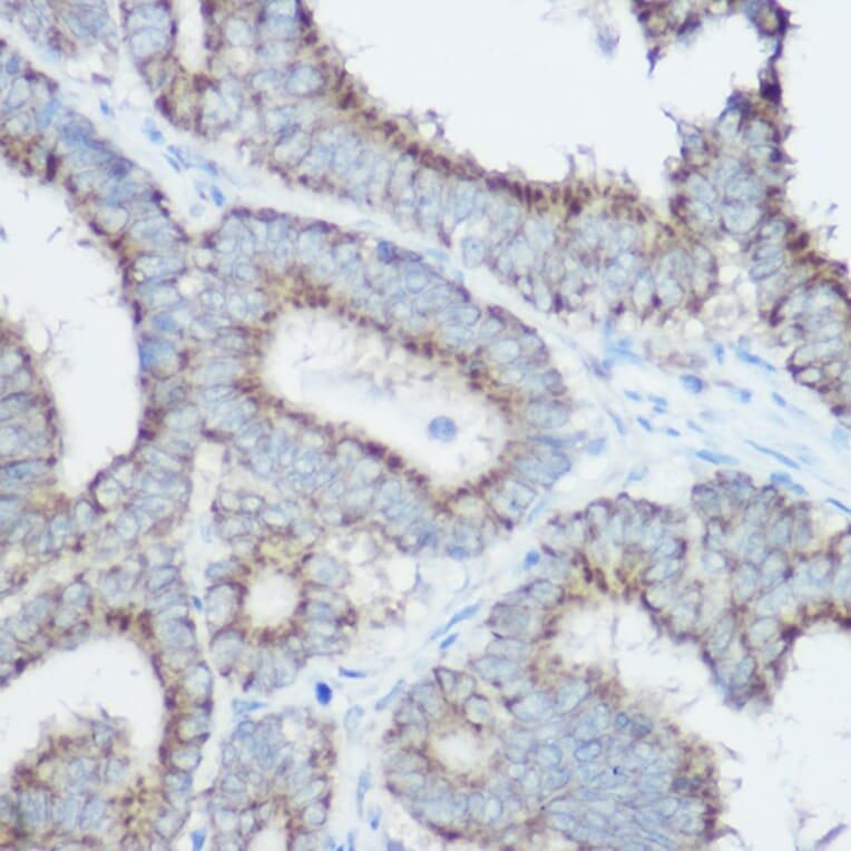 Immunohistochemistry - Anti-TOMM20 Antibody (A88476) - Antibodies.com