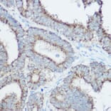 Immunohistochemistry - Anti-TOMM20 Antibody (A88476) - Antibodies.com