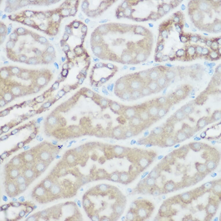 Immunohistochemistry - Anti-TOMM20 Antibody (A88476) - Antibodies.com