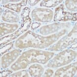 Immunohistochemistry - Anti-TOMM20 Antibody (A88476) - Antibodies.com