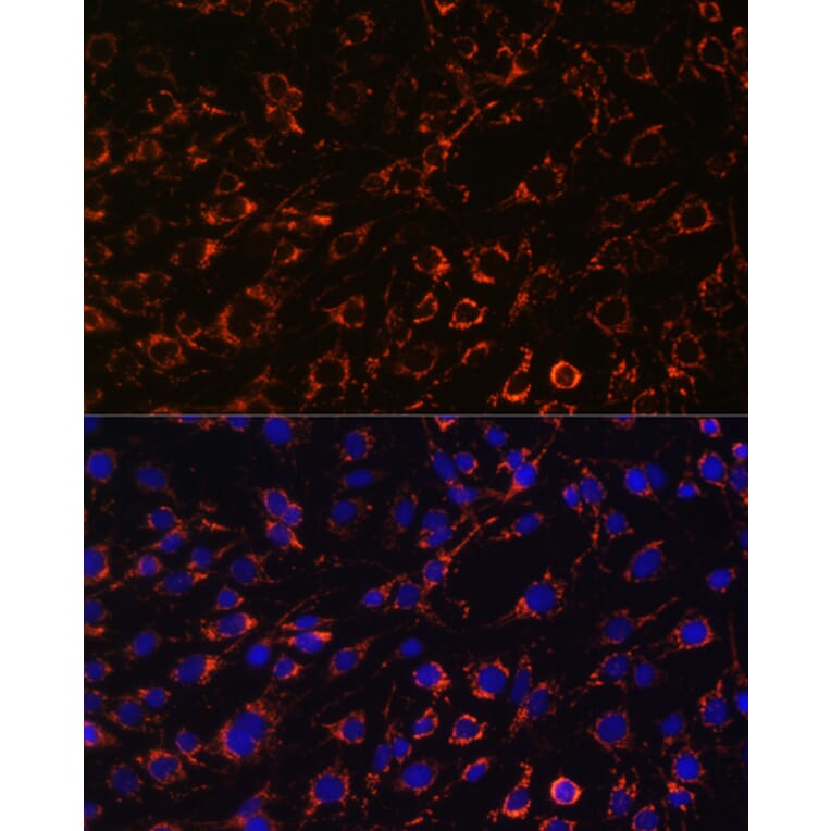 Immunofluorescence - Anti-TOMM20 Antibody (A88476) - Antibodies.com