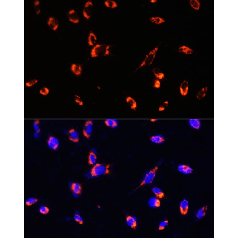 Immunofluorescence - Anti-TOMM20 Antibody (A88476) - Antibodies.com