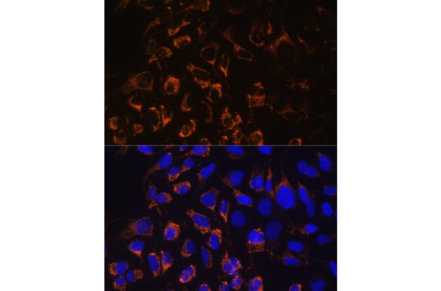 Immunofluorescence - Anti-TOMM20 Antibody (A88476) - Antibodies.com