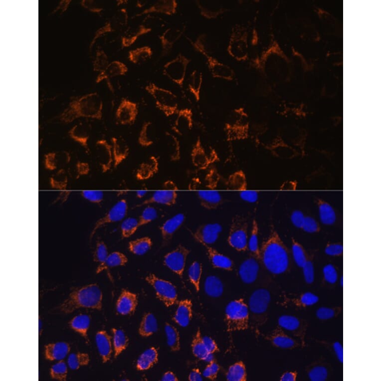 Immunofluorescence - Anti-TOMM20 Antibody (A88476) - Antibodies.com