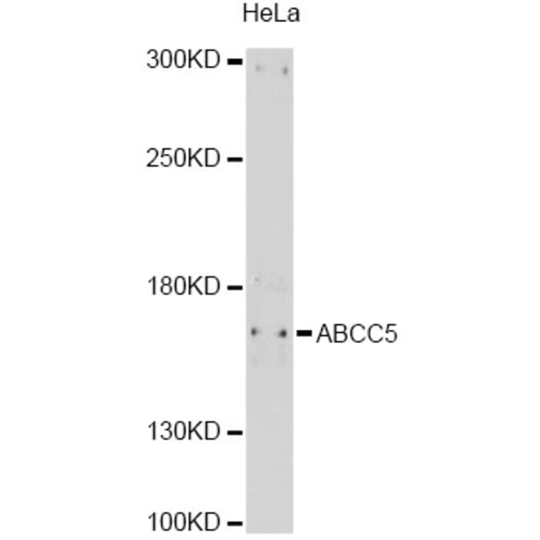 Western Blot - Anti-ABCC5 Antibody (A11978) - Antibodies.com
