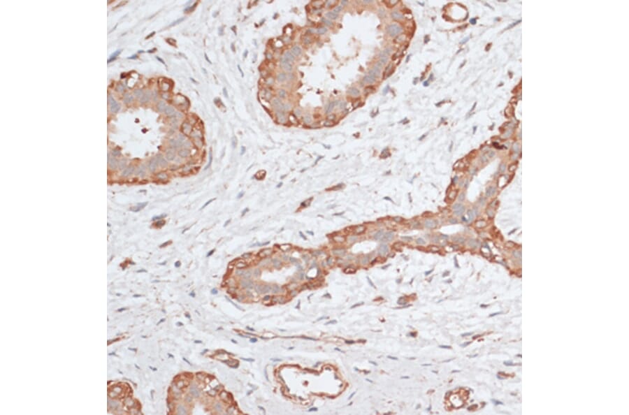 Immunohistochemistry - Anti-ABCC5 Antibody (A11978) - Antibodies.com