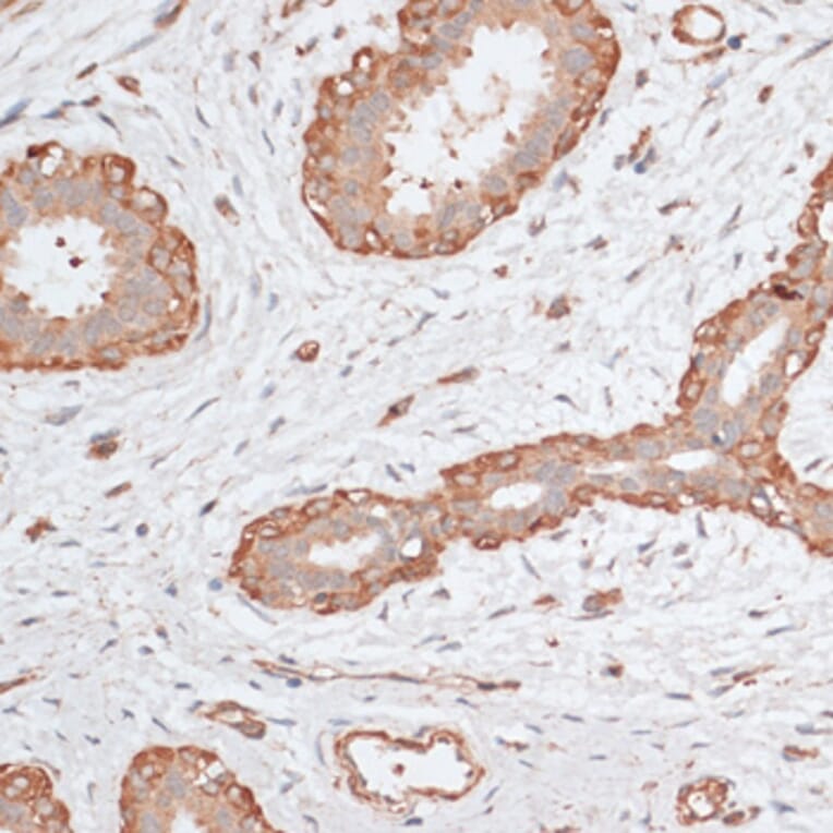 Immunohistochemistry - Anti-ABCC5 Antibody (A11978) - Antibodies.com