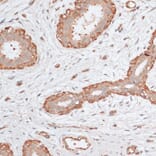 Immunohistochemistry - Anti-ABCC5 Antibody (A11978) - Antibodies.com