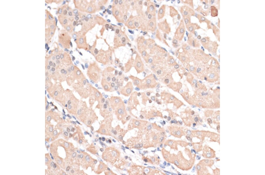Immunohistochemistry - Anti-ABCC5 Antibody (A11978) - Antibodies.com
