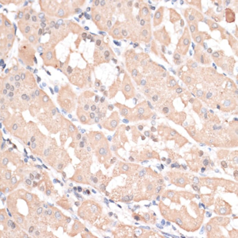 Immunohistochemistry - Anti-ABCC5 Antibody (A11978) - Antibodies.com