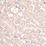Immunohistochemistry - Anti-ABCC5 Antibody (A11978) - Antibodies.com