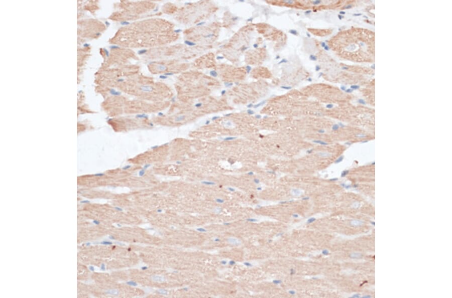 Immunohistochemistry - Anti-ABCC5 Antibody (A11978) - Antibodies.com
