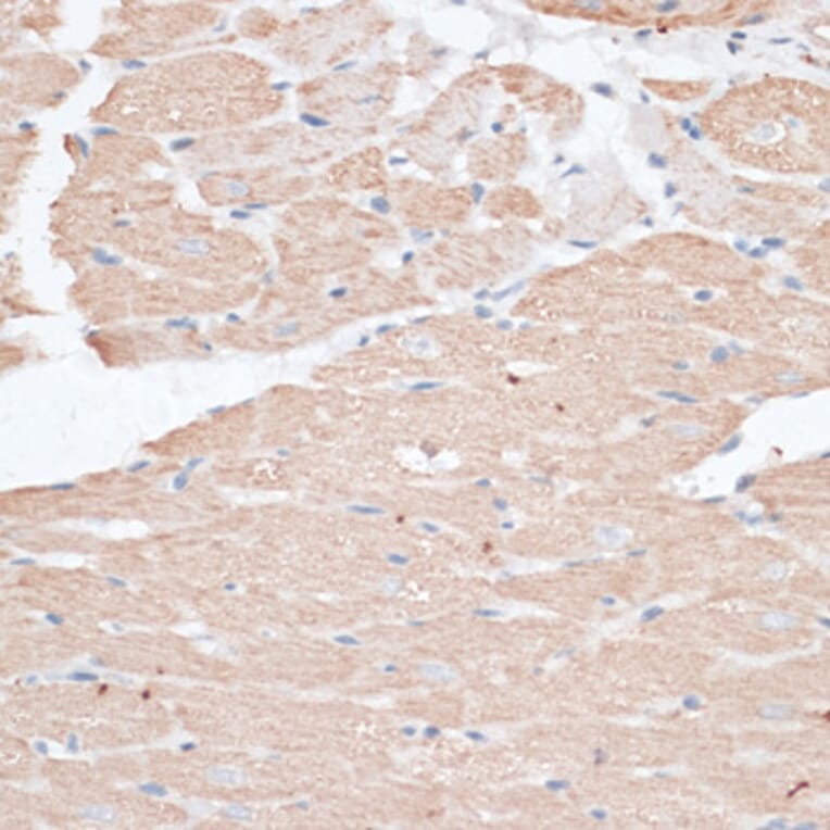 Immunohistochemistry - Anti-ABCC5 Antibody (A11978) - Antibodies.com