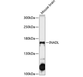 Western Blot - Anti-PATJ Antibody (A88478) - Antibodies.com