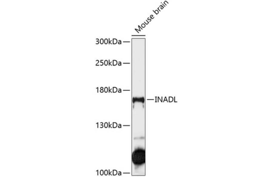 Western Blot - Anti-PATJ Antibody (A88478) - Antibodies.com