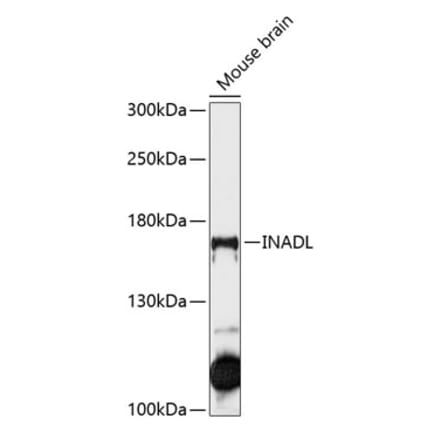 Western Blot - Anti-PATJ Antibody (A88478) - Antibodies.com