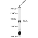Western Blot - Anti-PATJ Antibody (A88478) - Antibodies.com