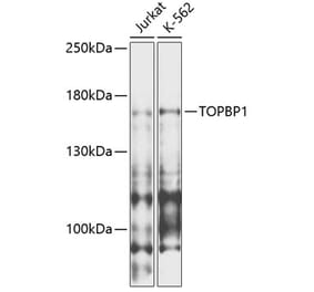 Western Blot - Anti-TopBP1 Antibody (A88479) - Antibodies.com