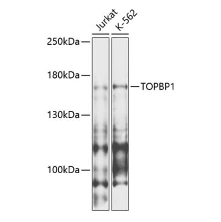Western Blot - Anti-TopBP1 Antibody (A88479) - Antibodies.com