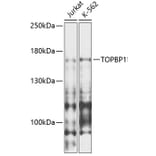 Western Blot - Anti-TopBP1 Antibody (A88479) - Antibodies.com