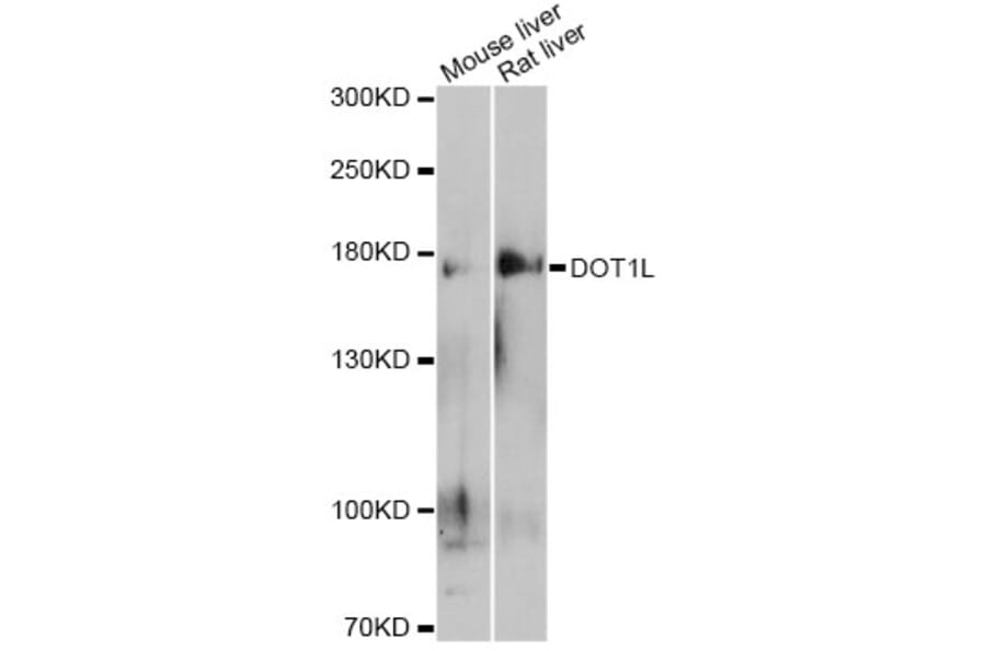 Western Blot - Anti-DOT1L Antibody (A12328) - Antibodies.com
