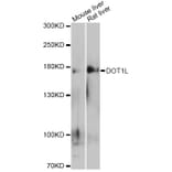 Western Blot - Anti-DOT1L Antibody (A12328) - Antibodies.com