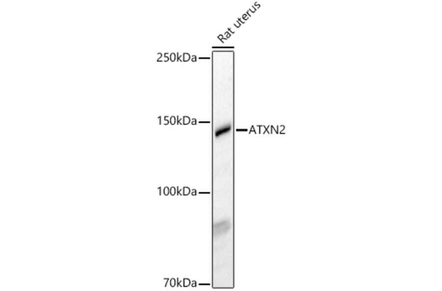 Western Blot - Anti-SCA2 Antibody (A88481) - Antibodies.com