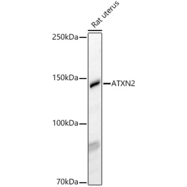Western Blot - Anti-SCA2 Antibody (A88481) - Antibodies.com