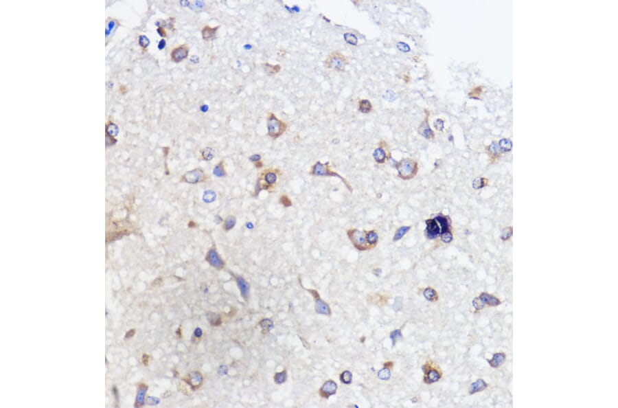 Immunohistochemistry - Anti-SCA2 Antibody (A88481) - Antibodies.com