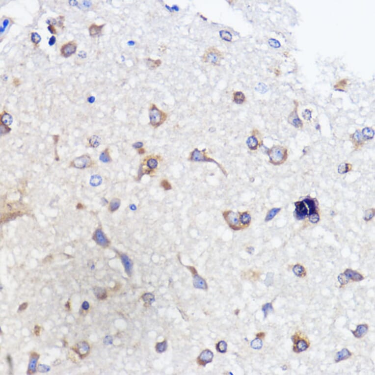 Immunohistochemistry - Anti-SCA2 Antibody (A88481) - Antibodies.com