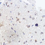Immunohistochemistry - Anti-SCA2 Antibody (A88481) - Antibodies.com
