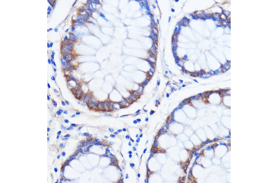 Immunohistochemistry - Anti-SCA2 Antibody (A88481) - Antibodies.com