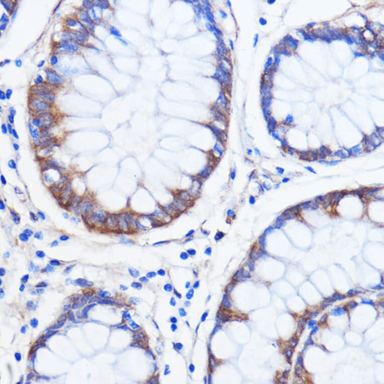 Immunohistochemistry - Anti-SCA2 Antibody (A88481) - Antibodies.com