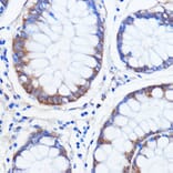 Immunohistochemistry - Anti-SCA2 Antibody (A88481) - Antibodies.com