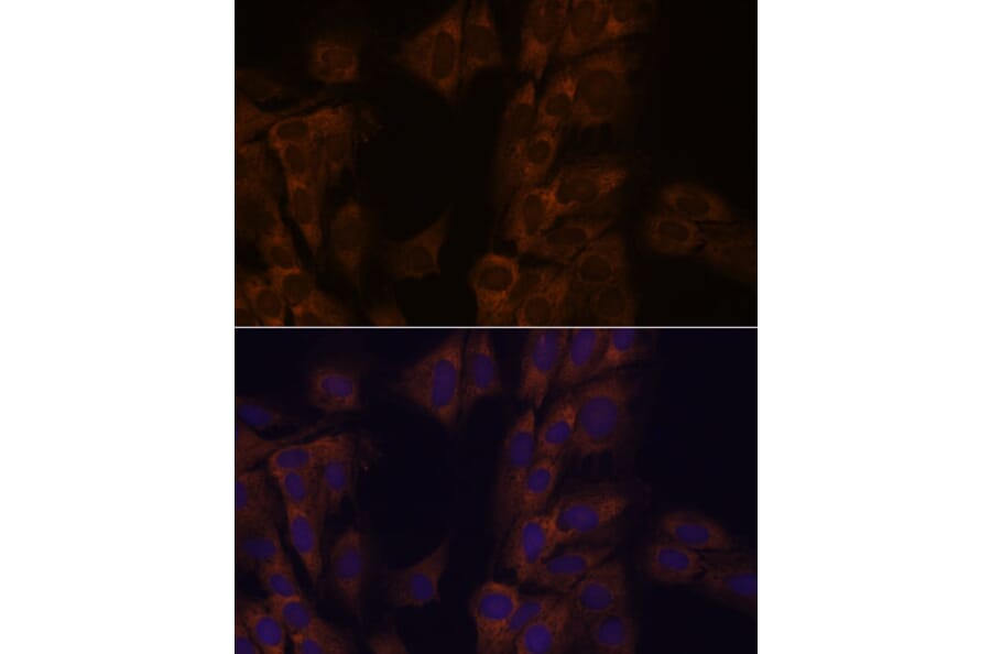 Immunofluorescence - Anti-SCA2 Antibody (A88481) - Antibodies.com