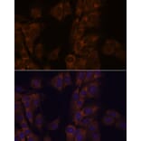 Immunofluorescence - Anti-SCA2 Antibody (A88481) - Antibodies.com