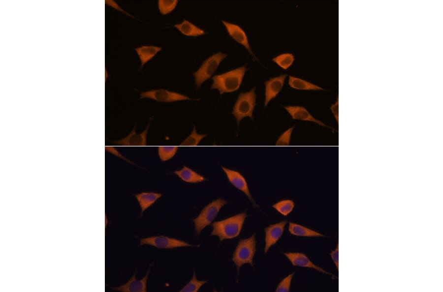 Immunofluorescence - Anti-SCA2 Antibody (A88481) - Antibodies.com