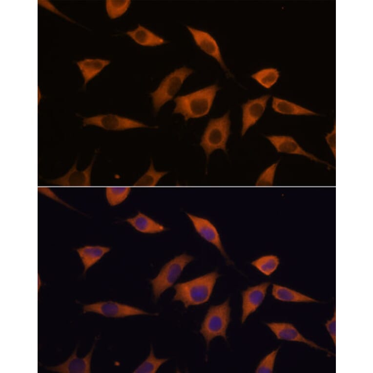 Immunofluorescence - Anti-SCA2 Antibody (A88481) - Antibodies.com