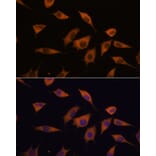 Immunofluorescence - Anti-SCA2 Antibody (A88481) - Antibodies.com