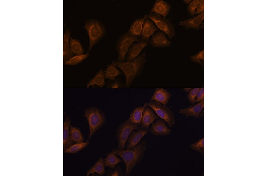 Immunofluorescence - Anti-SCA2 Antibody (A88481) - Antibodies.com