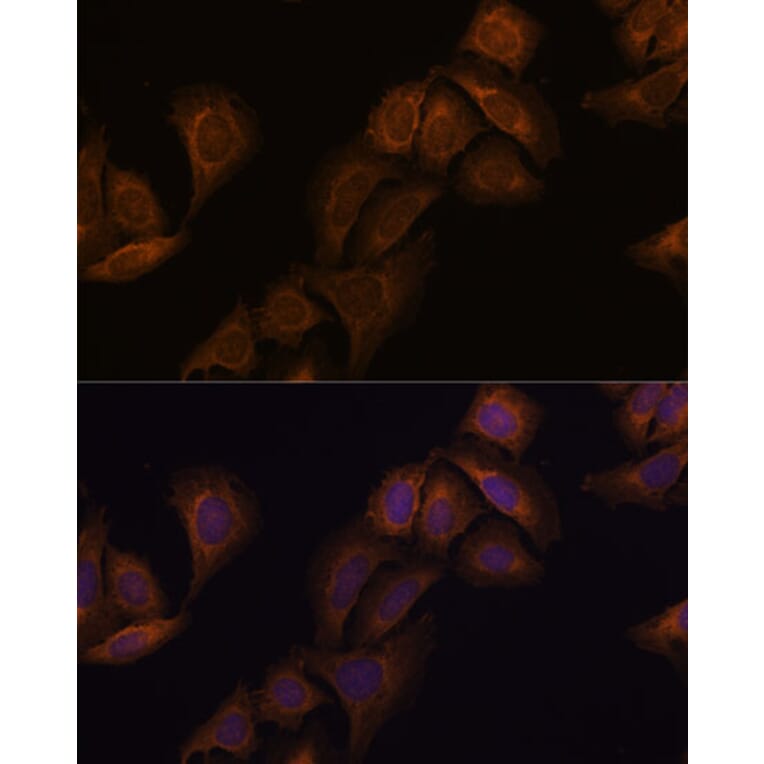 Immunofluorescence - Anti-SCA2 Antibody (A88481) - Antibodies.com