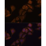 Immunofluorescence - Anti-SCA2 Antibody (A88481) - Antibodies.com