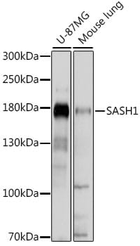 Western blot analysis of extracts of various cell lines, using Anti-SASH1 Antibody (A15248) at 1:1,000 dilution.
Secondary antibody: Goat Anti-Rabbit IgG (H+L) (HRP) (AS014) at 1:10,000 dilution.
Lysates / proteins: 25µg per lane.
Blocking buffer: 3% non-fat dry milk in TBST.
Detection: ECL Basic Kit (RM00020).
Exposure time: 5s.