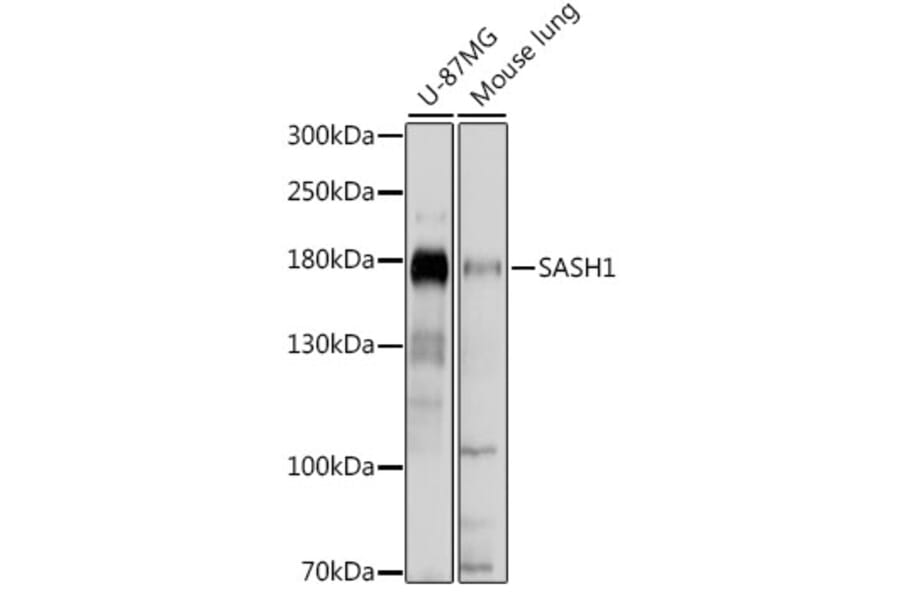 Western Blot - Anti-SASH1 Antibody (A88483) - Antibodies.com