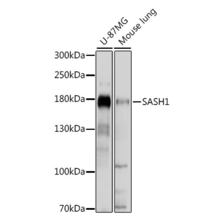 Western Blot - Anti-SASH1 Antibody (A88483) - Antibodies.com