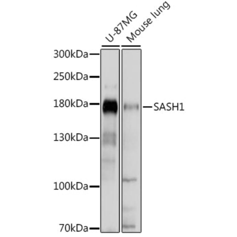 Western Blot - Anti-SASH1 Antibody (A88483) - Antibodies.com