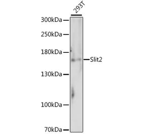 Western Blot - Anti-Slit2 Antibody (A88485) - Antibodies.com