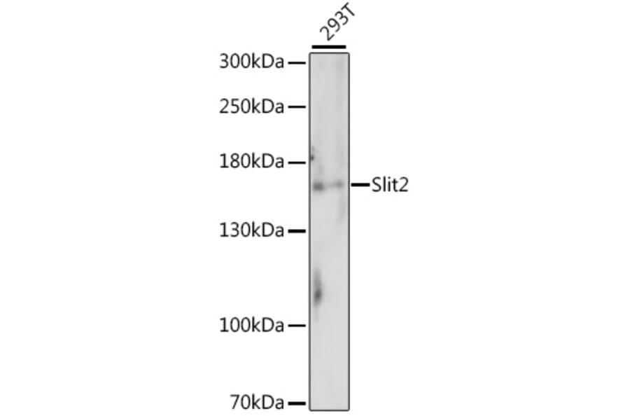 Western Blot - Anti-Slit2 Antibody (A88485) - Antibodies.com