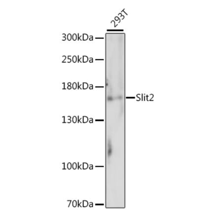 Western Blot - Anti-Slit2 Antibody (A88485) - Antibodies.com