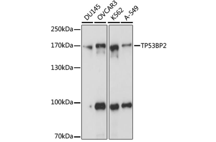 Western Blot - Anti-TP53BP2 Antibody (A15105) - Antibodies.com